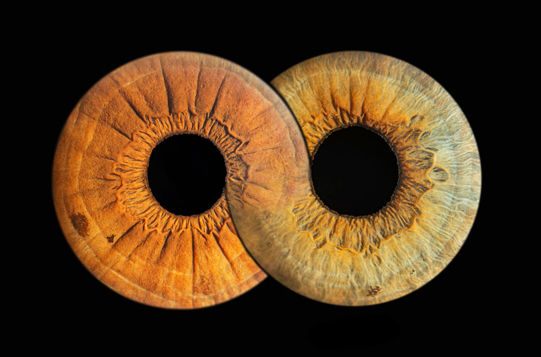 Gros plan sur deux iris d’yeux en studio à Bressuire